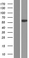 CAMK2B Human Over-expression Lysate
