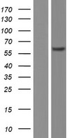 CAMK2B Human Over-expression Lysate