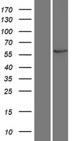 CAMK2B Human Over-expression Lysate