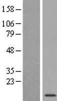 WFDC10B Human Over-expression Lysate