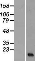 SERHL Human Over-expression Lysate