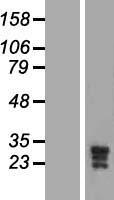 KCNMB3 Human Over-expression Lysate