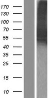 CAMKK2 Human Over-expression Lysate