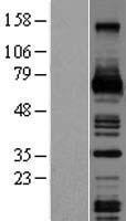 M-CSF (CSF1) Human Over-expression Lysate