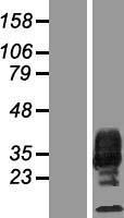 M-CSF (CSF1) Human Over-expression Lysate