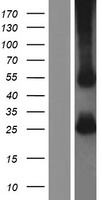 Tapasin (TAPBP) Human Over-expression Lysate