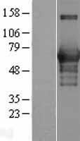 CaMKK (CAMKK1) Human Over-expression Lysate