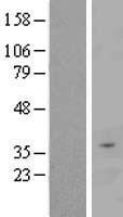 FBXO16 Human Over-expression Lysate
