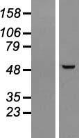 C14orf50 (PPP1R36) Human Over-expression Lysate