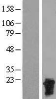 CTAG2 Human Over-expression Lysate