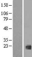 IL1F10 Human Over-expression Lysate
