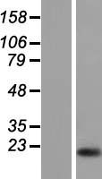 Calpain 3 (CAPN3) Human Over-expression Lysate