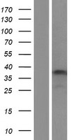 Calpain 3 (CAPN3) Human Over-expression Lysate