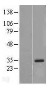 IL18BP Human Over-expression Lysate