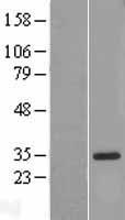 IL18BP Human Over-expression Lysate
