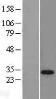 TGIF (TGIF1) Human Over-expression Lysate