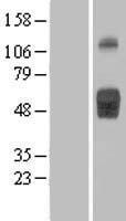 IL1 Receptor II (IL1R2) Human Over-expression Lysate