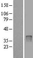 UPP2 Human Over-expression Lysate