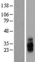 TIGIT Human Over-expression Lysate