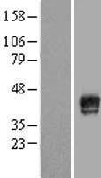 MAGEB18 Human Over-expression Lysate