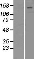 ATP11C Human Over-expression Lysate