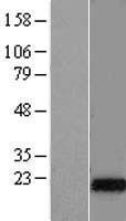 DNAJC5G Human Over-expression Lysate
