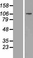 CCDC141 Human Over-expression Lysate
