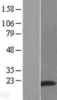 RNF149 Human Over-expression Lysate