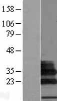 C19orf75 (SIGLECL1) Human Over-expression Lysate