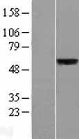 SLC39A5 Human Over-expression Lysate