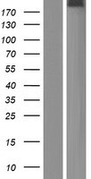 OTOGL Human Over-expression Lysate