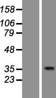 EFCAB4A (CRACR2B) Human Over-expression Lysate