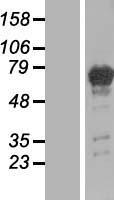 PGM2L1 Human Over-expression Lysate