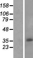 C11orf72 Human Over-expression Lysate