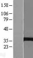 ABHD7 (EPHX4) Human Over-expression Lysate