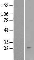 RNF152 Human Over-expression Lysate