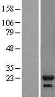 IL1RA (IL1RN) Human Over-expression Lysate