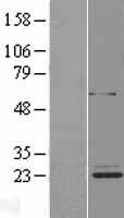 ETFBKMT Human Over-expression Lysate