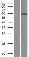 C14ORF21 (NOP9) Human Over-expression Lysate