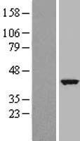 DYNLT2 Human Over-expression Lysate