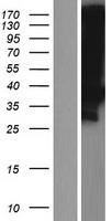 LDLRAD3 Human Over-expression Lysate