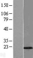 TMEM80 Human Over-expression Lysate