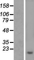 Aprataxin (APTX) Human Over-expression Lysate