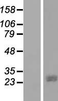 JAZF1 Human Over-expression Lysate