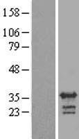 RALYL Human Over-expression Lysate