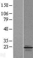 TPPP2 Human Over-expression Lysate
