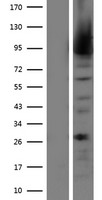 MALT1 Human Over-expression Lysate