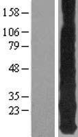 MT1E Human Over-expression Lysate