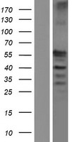 SPEM2 Human Over-expression Lysate