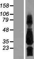 SCN4B Human Over-expression Lysate